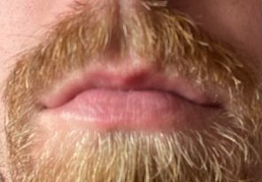 1. Mouth.jpg